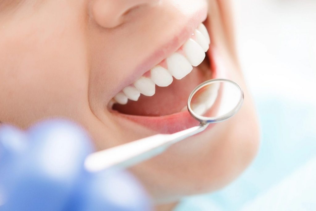 A woman being examined with a dental mirror.