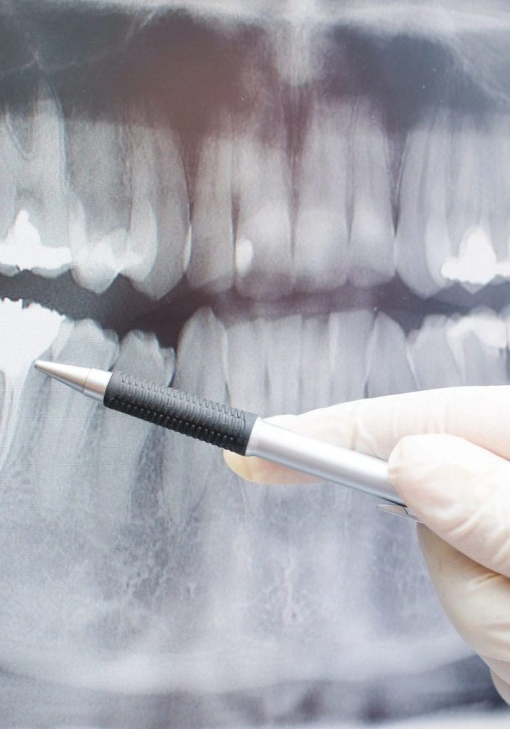 An image of a dental x-ray.