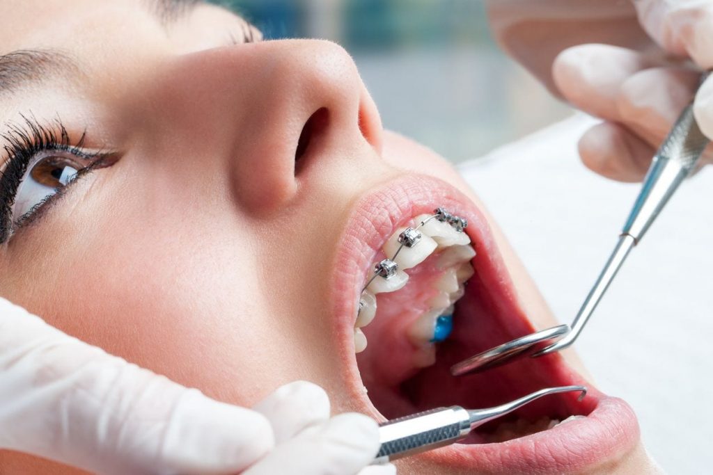 A girl with braces being examined by a dentist.