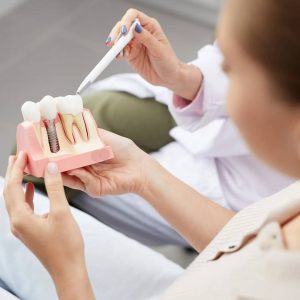 Dental Implants Windsor ON