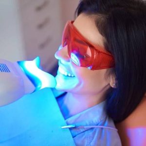 professional teeth whitening Windsor
